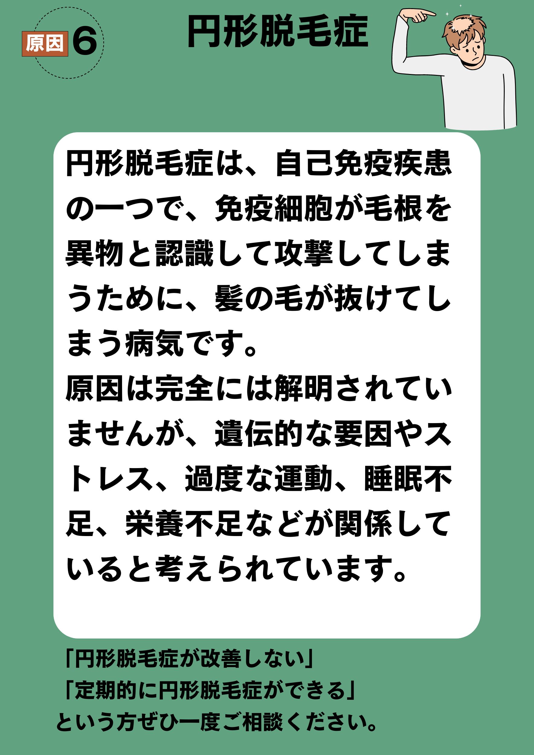 原因6　円形脱毛症
円形脱毛症は、自己免疫疾患の一つで、免疫細胞が毛根を異物と認識して攻撃してしまうために、髪の毛が抜けてしまう病気です。
原因は完全には解明されていませんが、遺伝的な要因やストレス、過度な運動、睡眠不足、栄養不足などが関係していると考えられています。
「円形脱毛症が改善しない」
「定期的に円形脱毛症ができる」
という方ぜひ一度ご相談ください。