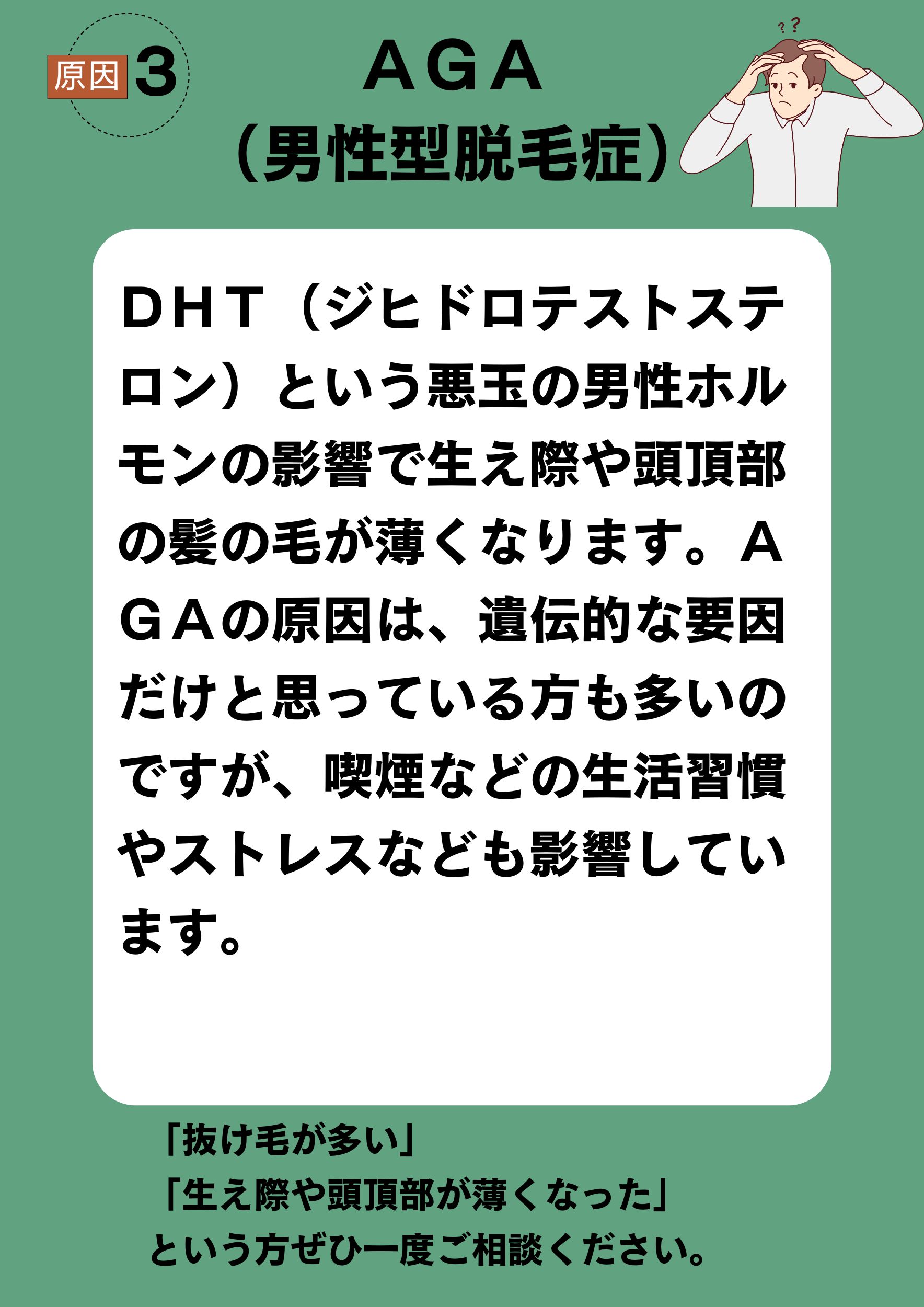 原因3　ＡＧＡ（男性型脱毛症）
ＤＨＴ（ジヒドロテストステロン）という悪玉の男性ホルモンの影響で生え際や頭頂部の髪の毛が薄くなります。ＡＧＡの原因は、遺伝的な要因だけと思っている方も多いのですが、喫煙などの生活習慣やストレスなども影響しています。
「抜け毛が多い」
「生え際や頭頂部が薄くなった」
という方ぜひ一度ご相談ください。